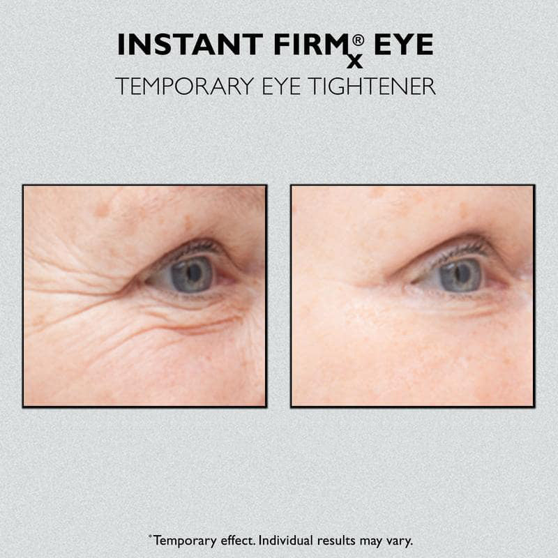 UGLOW™ -  Instant Temporary Eye Tightener