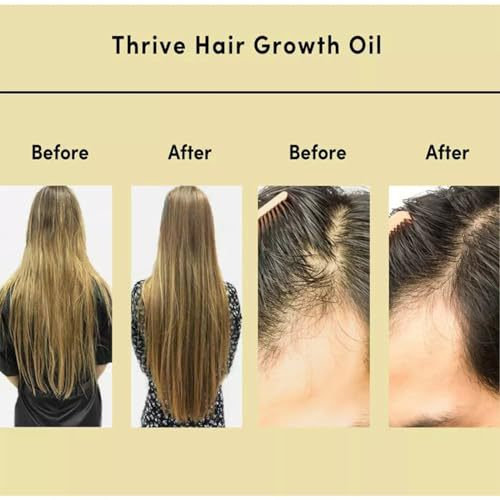 4-in-1 Scalp Massaging & Hair Growth Oil