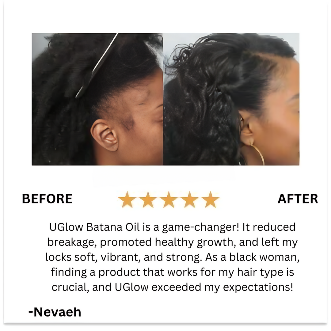 Batana Natural Hair Growth Oil