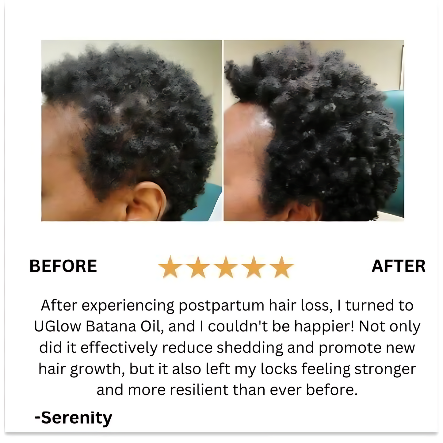 Batana Natural Hair Growth Oil